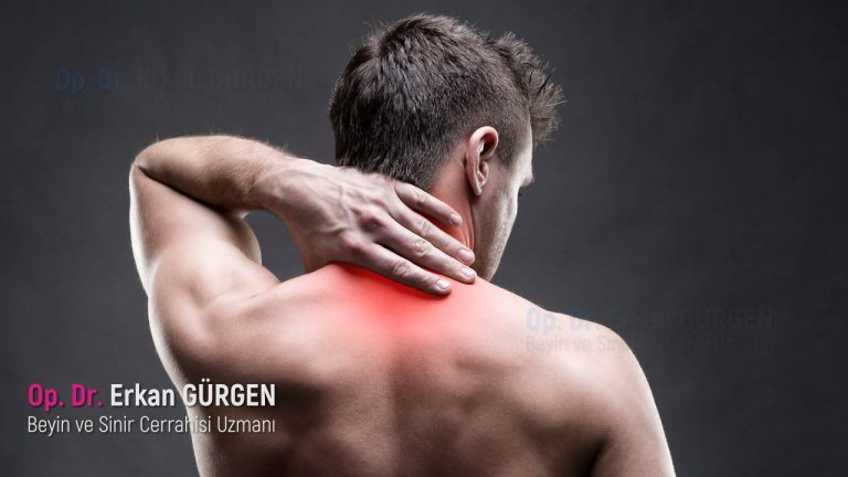 Boyun Fıtığı Belirtileri Nelerdir?